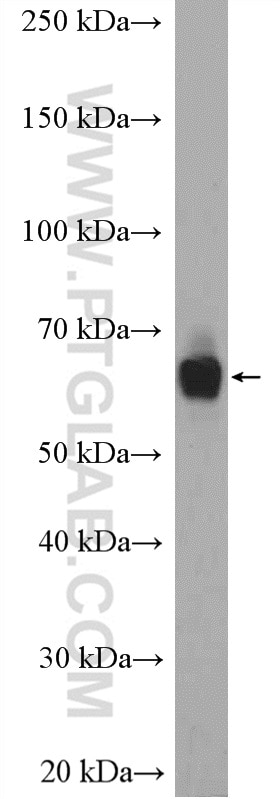 WB analysis of Jurkat using 23772-1-AP