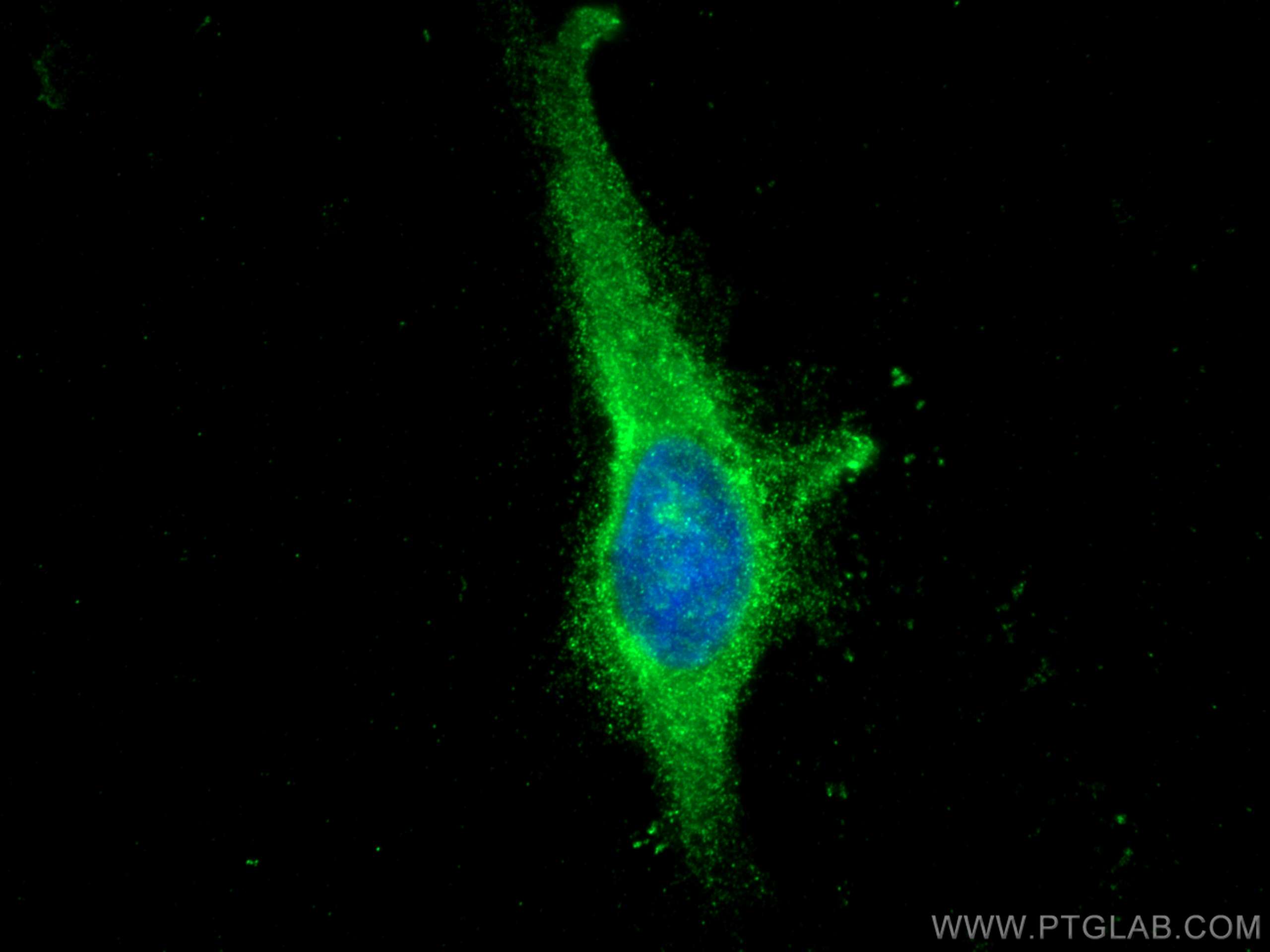Immunofluorescence (IF) / fluorescent staining of HeLa cells using MON1B Polyclonal antibody (17638-1-AP)