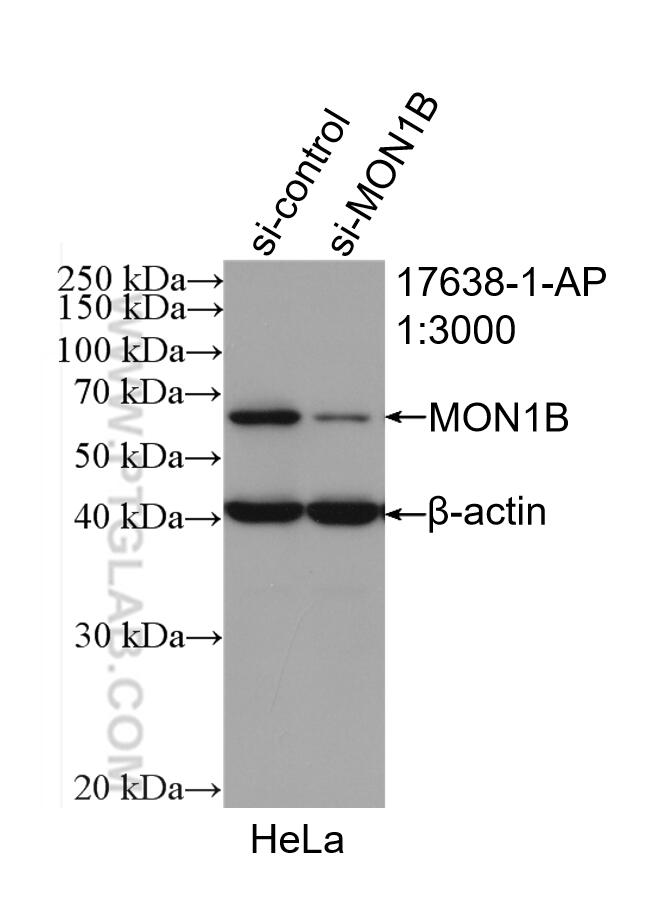Western Blot (WB) analysis of HeLa cells using MON1B Polyclonal antibody (17638-1-AP)