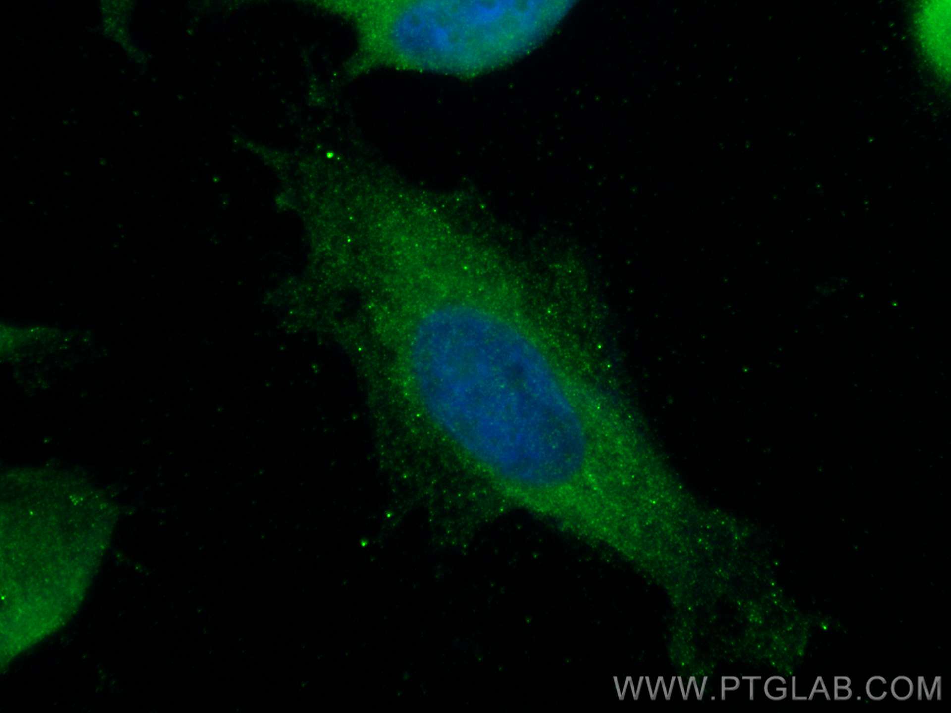 Immunofluorescence (IF) / fluorescent staining of HeLa cells using MON1B Monoclonal antibody (67985-1-Ig)