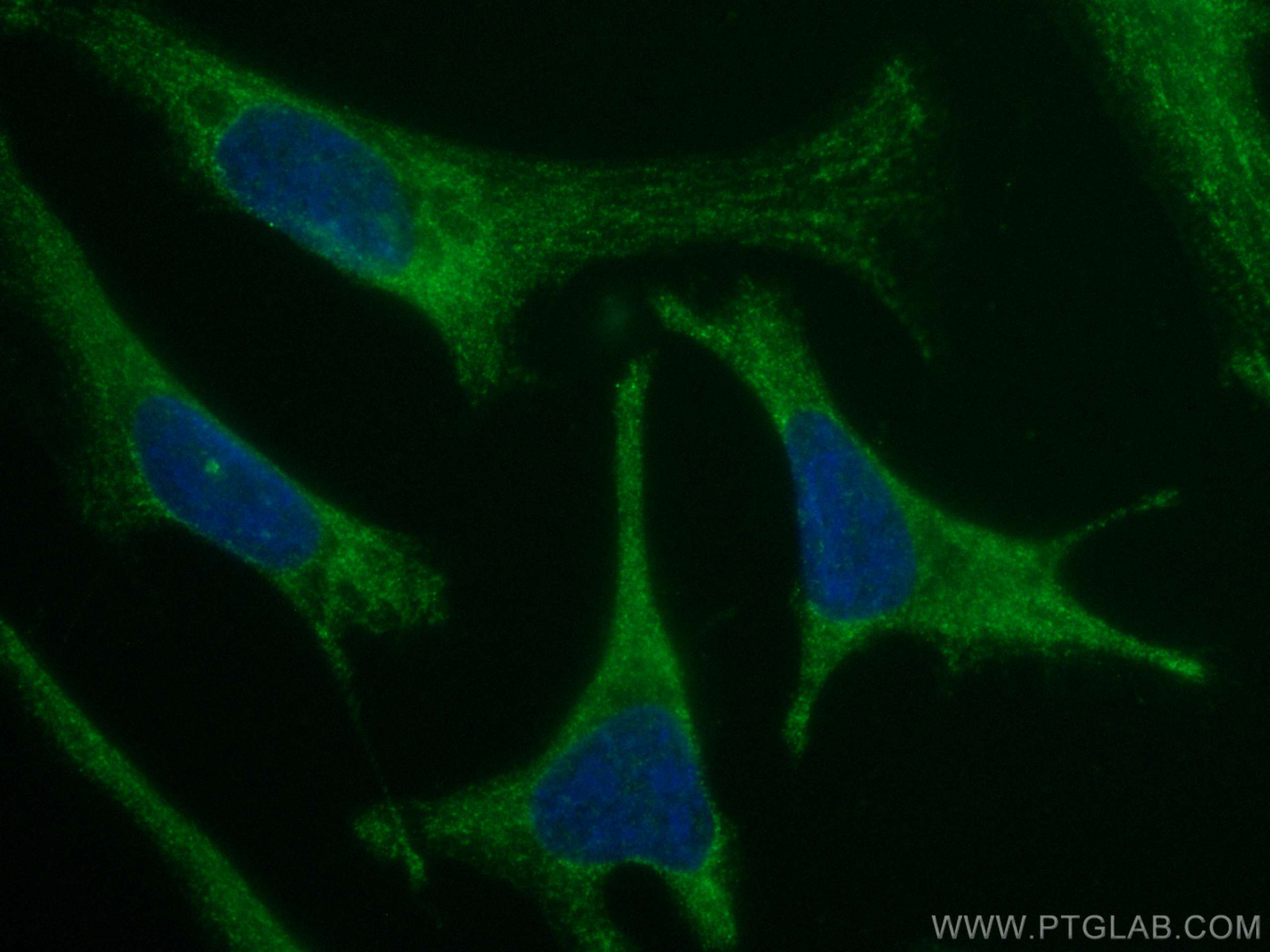 Immunofluorescence (IF) / fluorescent staining of HeLa cells using CoraLite® Plus 488-conjugated MON1B Monoclonal ant (CL488-67985)