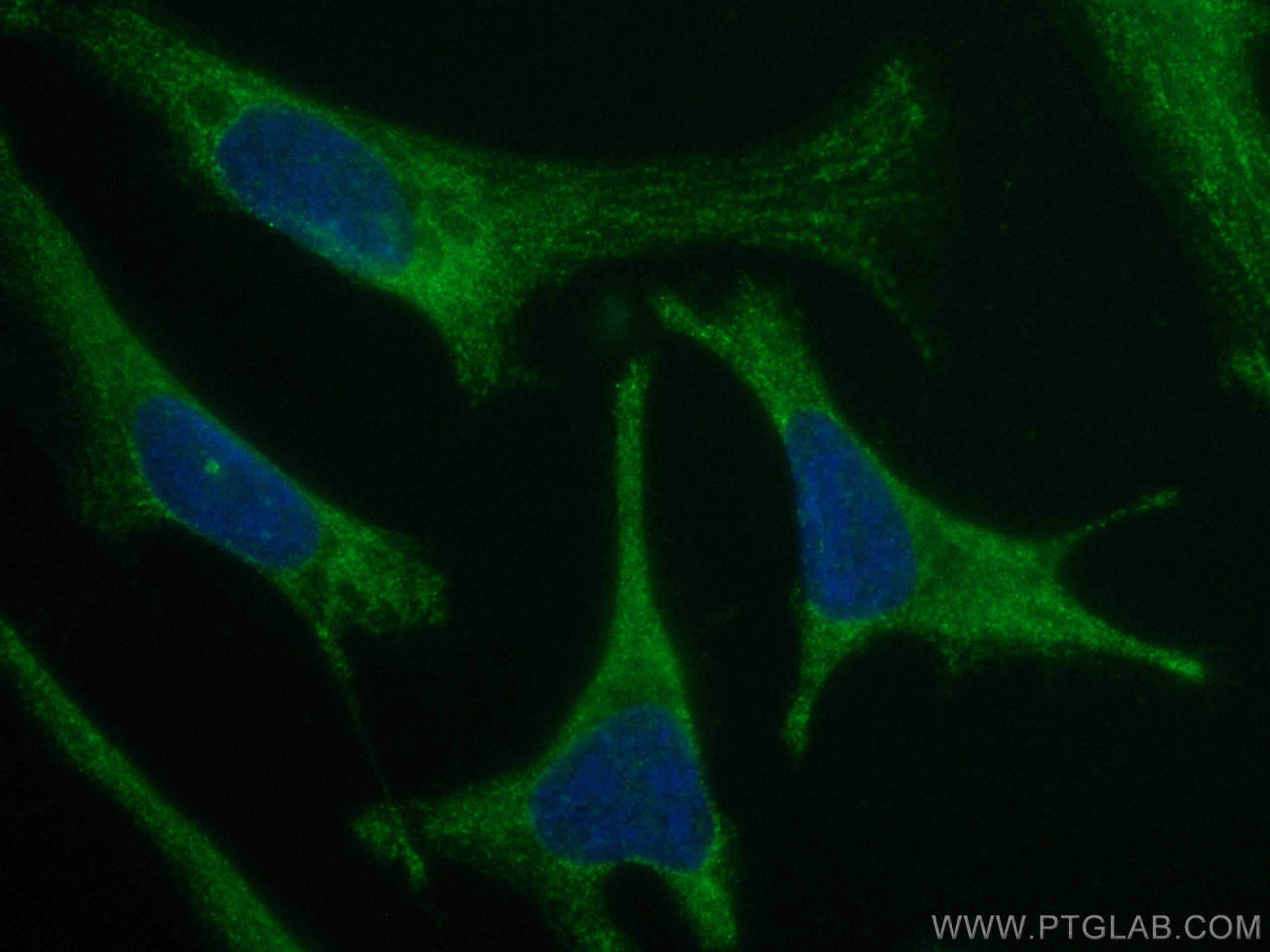 IF Staining of HeLa using CL488-67985