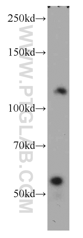 Western Blot (WB) analysis of human testis tissue using MORC1 Polyclonal antibody (14080-1-AP)