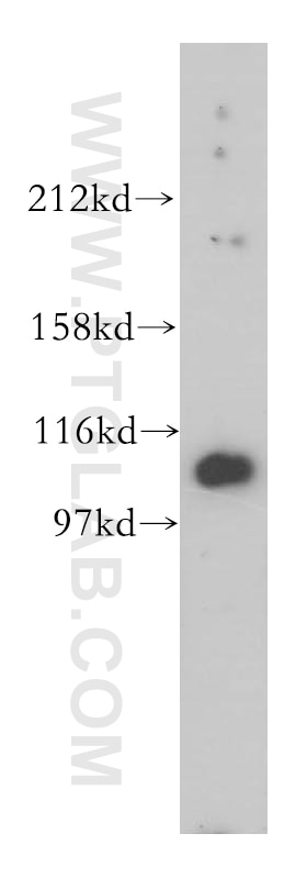 Western Blot (WB) analysis of mouse testis tissue using MORC1 Polyclonal antibody (14080-1-AP)