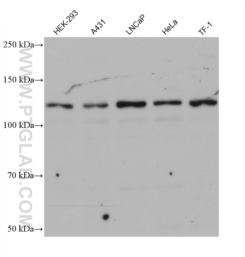 Western Blot (WB) analysis of various lysates using MORC2 Monoclonal antibody (68530-1-Ig)