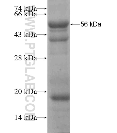 MORC2 fusion protein Ag19605 SDS-PAGE