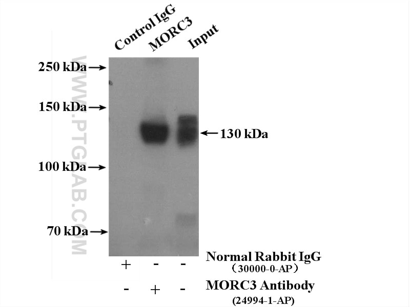 Immunoprecipitation (IP) experiment of HeLa cells using MORC3 Polyclonal antibody (24994-1-AP)