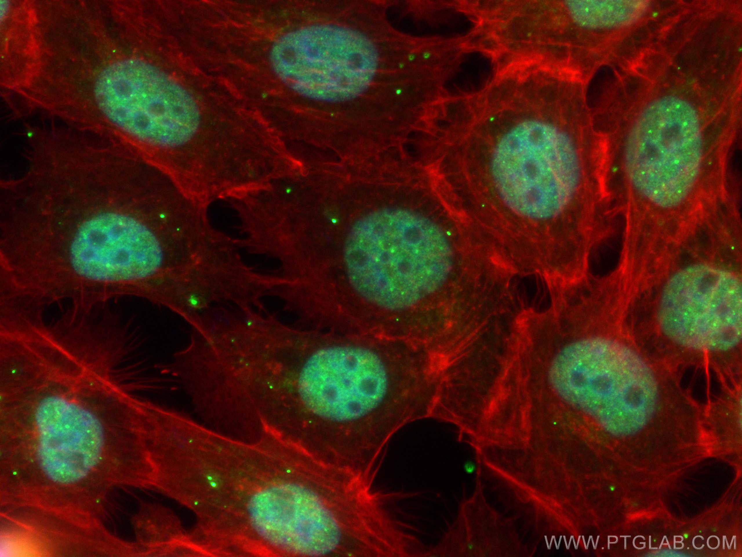 Immunofluorescence (IF) / fluorescent staining of A431 cells using CoraLite® Plus 488-conjugated MORC3 Polyclonal ant (CL488-24994)