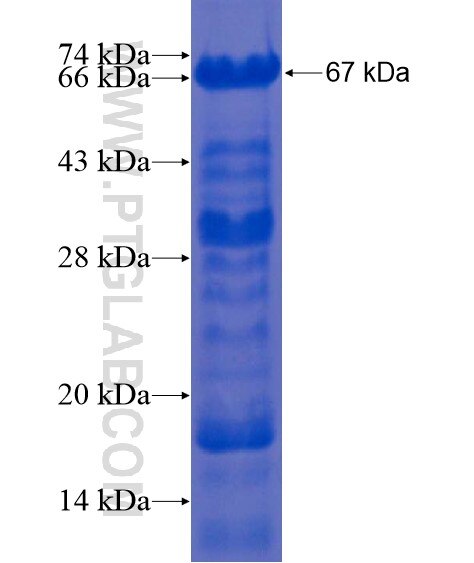 MORC3 fusion protein Ag21867 SDS-PAGE