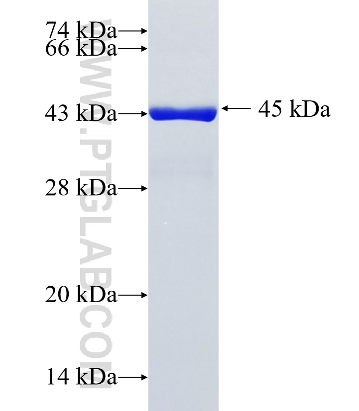 MORC4 fusion protein Ag35826 SDS-PAGE MORC4 fusion protein Ag35826 SDS-PAGE