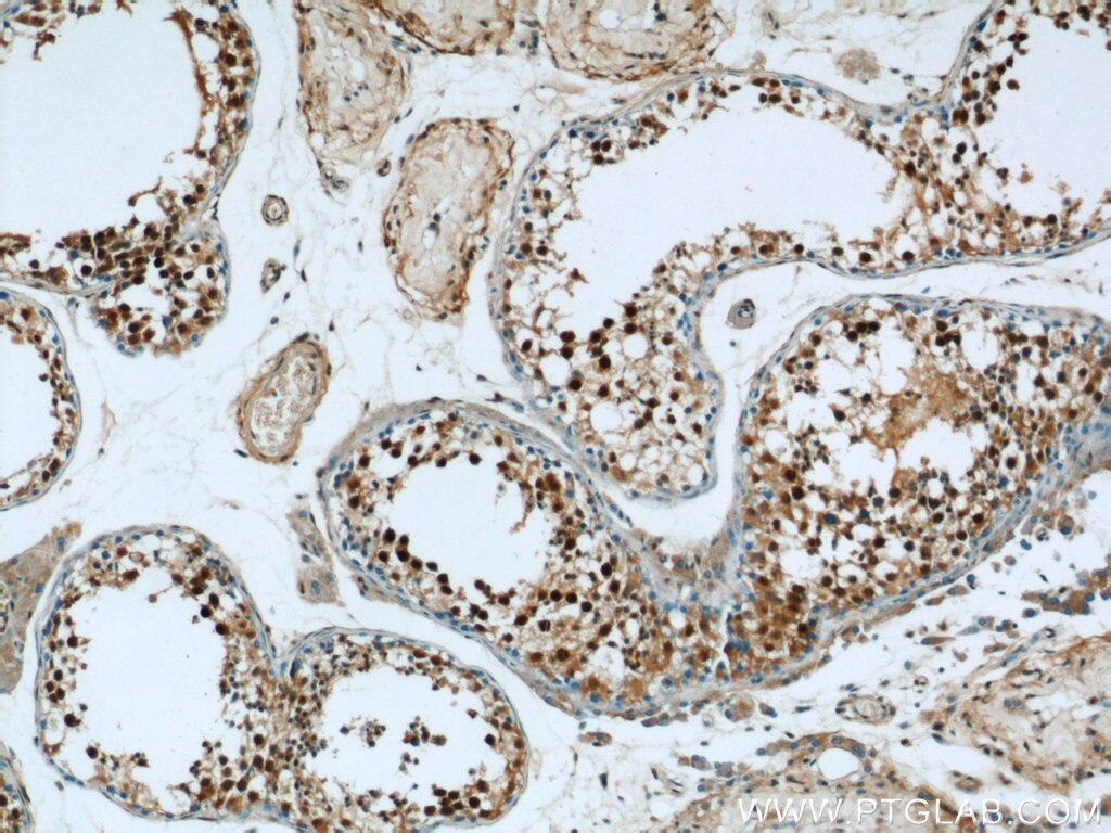 Immunohistochemistry (IHC) staining of human testis tissue using MORF4L1 Polyclonal antibody (55257-1-AP)