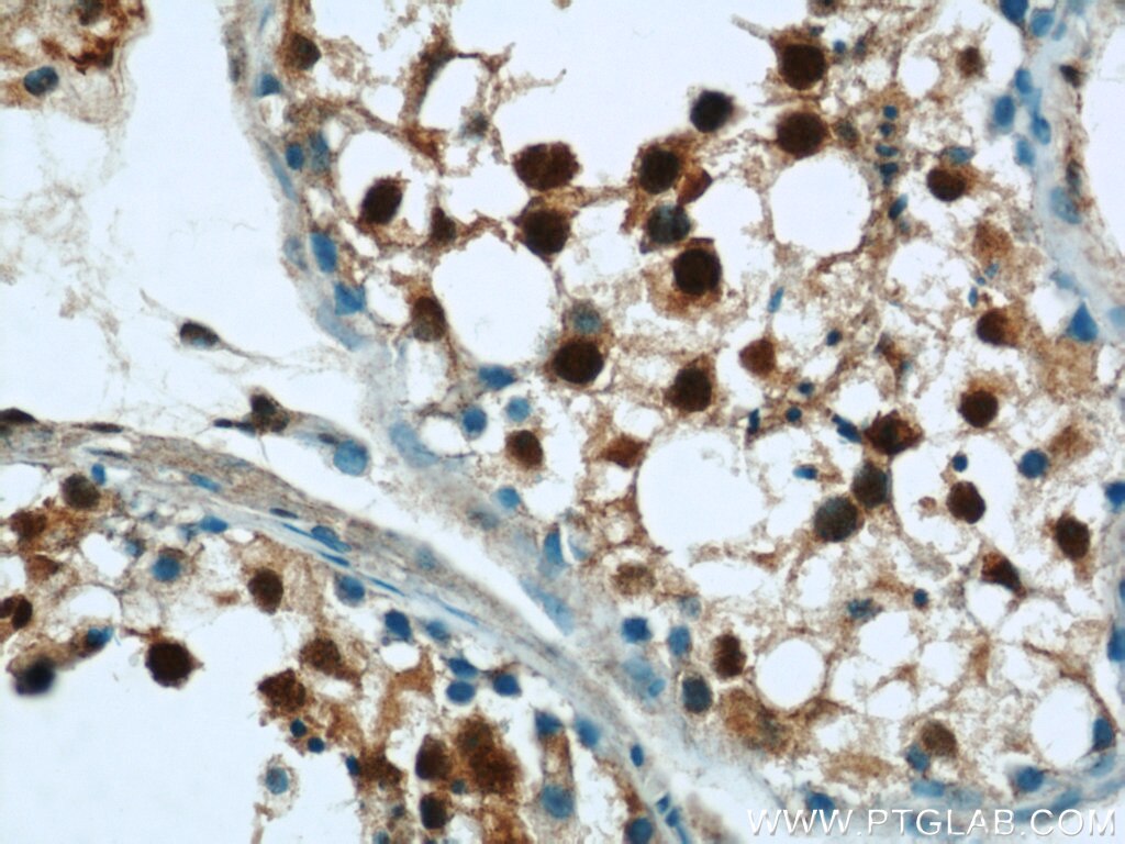 Immunohistochemistry (IHC) staining of human testis tissue using MORF4L1 Polyclonal antibody (55257-1-AP)