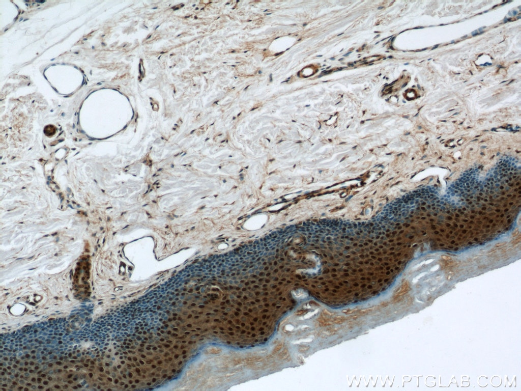 Immunohistochemistry (IHC) staining of human skin tissue using MORF4L1 Polyclonal antibody (55257-1-AP)