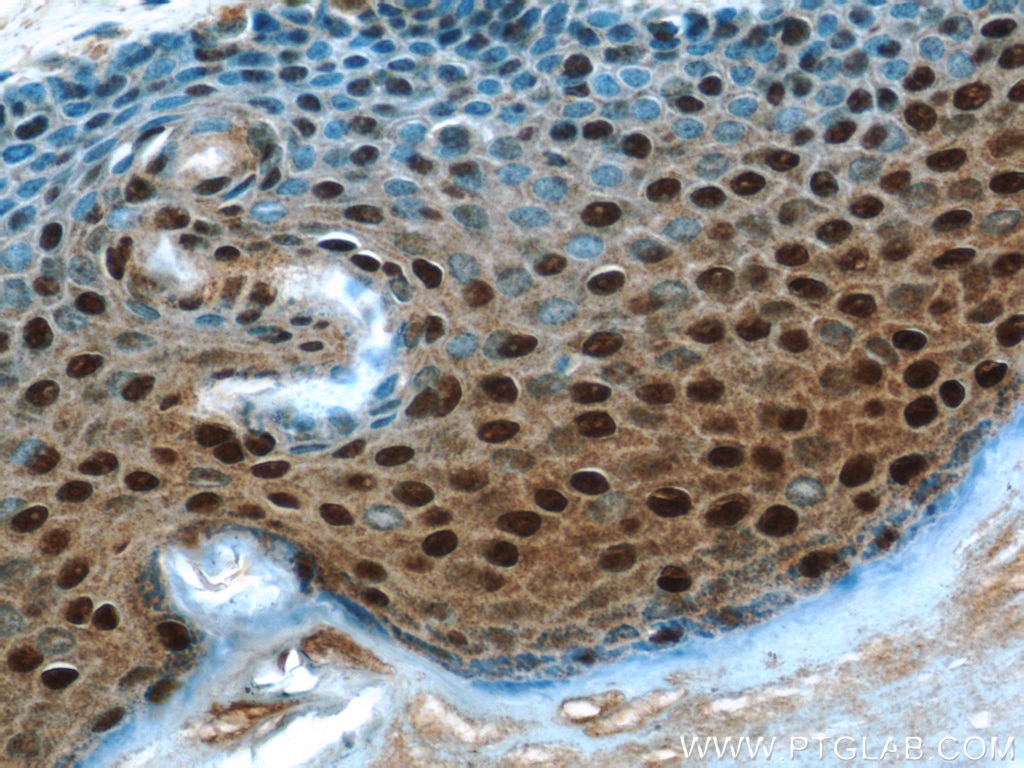 Immunohistochemistry (IHC) staining of human skin tissue using MORF4L1 Polyclonal antibody (55257-1-AP)