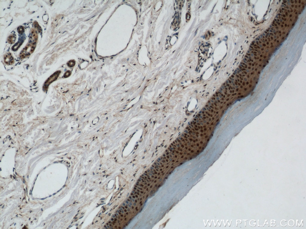 Immunohistochemistry (IHC) staining of human skin tissue using MORF4L1 Polyclonal antibody (55257-1-AP)