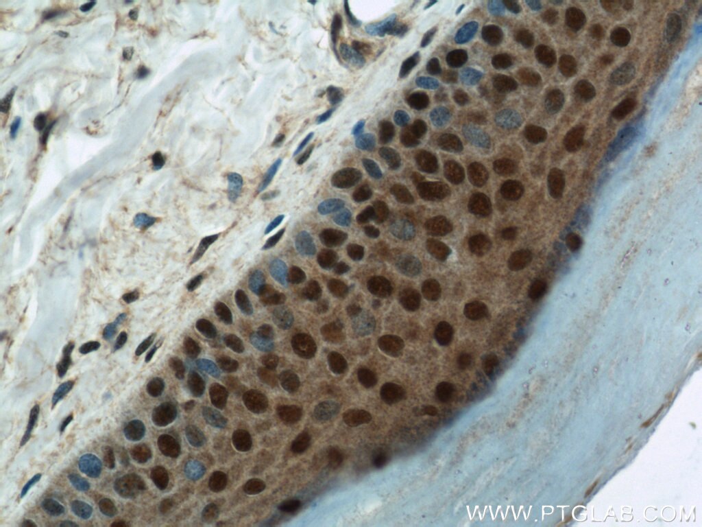 Immunohistochemistry (IHC) staining of human skin tissue using MORF4L1 Polyclonal antibody (55257-1-AP)