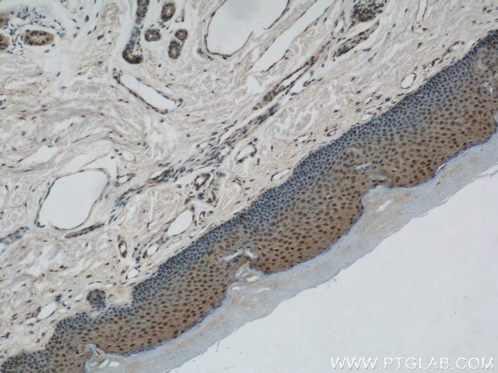 Immunohistochemistry (IHC) staining of human skin tissue using MORF4L1 Polyclonal antibody (55257-1-AP)