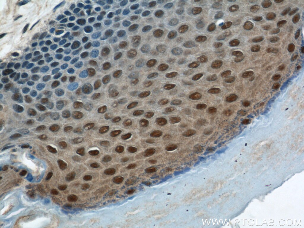 Immunohistochemistry (IHC) staining of human skin tissue using MORF4L1 Polyclonal antibody (55257-1-AP)
