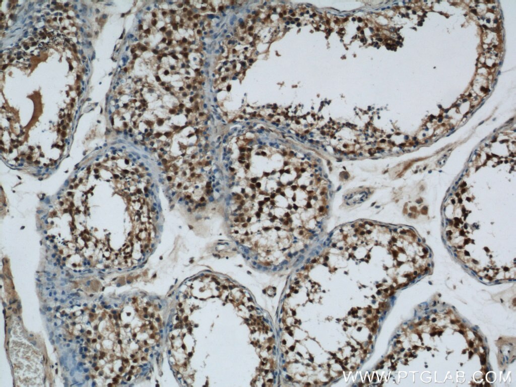 Immunohistochemistry (IHC) staining of human testis tissue using MORF4L1 Polyclonal antibody (55257-1-AP)