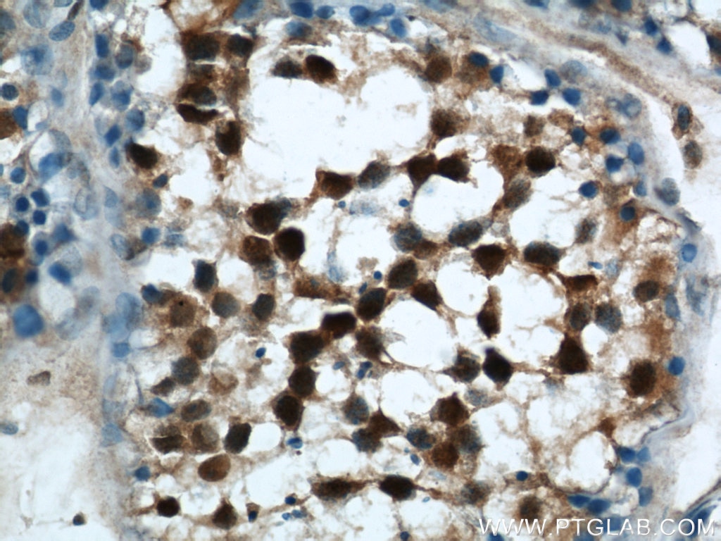 Immunohistochemistry (IHC) staining of human testis tissue using MORF4L1 Polyclonal antibody (55257-1-AP)