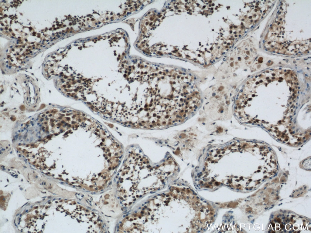 Immunohistochemistry (IHC) staining of human testis tissue using MORF4L1 Polyclonal antibody (55257-1-AP)