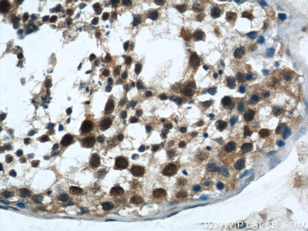 Immunohistochemistry (IHC) staining of human testis tissue using MORF4L1 Polyclonal antibody (55257-1-AP)