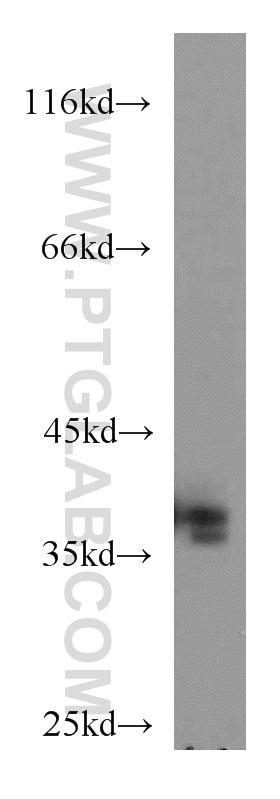 Western Blot (WB) analysis of mouse brain tissue using MORF4L1 Polyclonal antibody (55257-1-AP)
