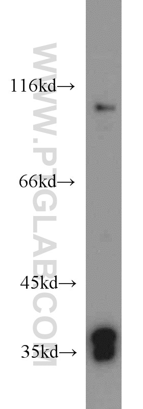 Western Blot (WB) analysis of HEK-293 cells using MORF4L1 Polyclonal antibody (55257-1-AP)