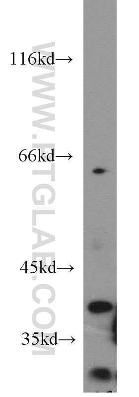 Western Blot (WB) analysis of A549 cells using MORF4L1 Polyclonal antibody (55257-1-AP)