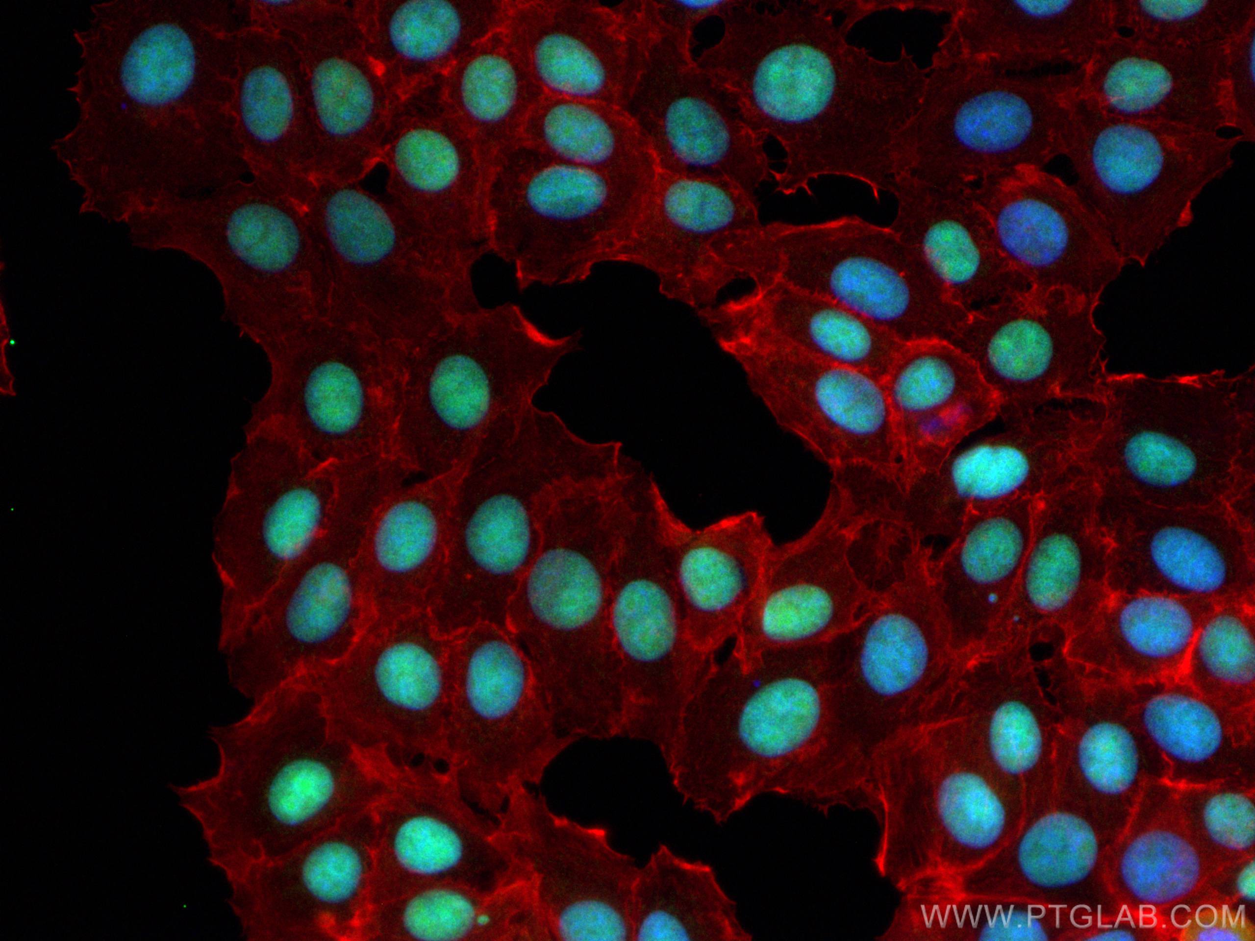 Immunofluorescence (IF) / fluorescent staining of MCF-7 cells using MORF4L2 Polyclonal antibody (14710-1-AP)