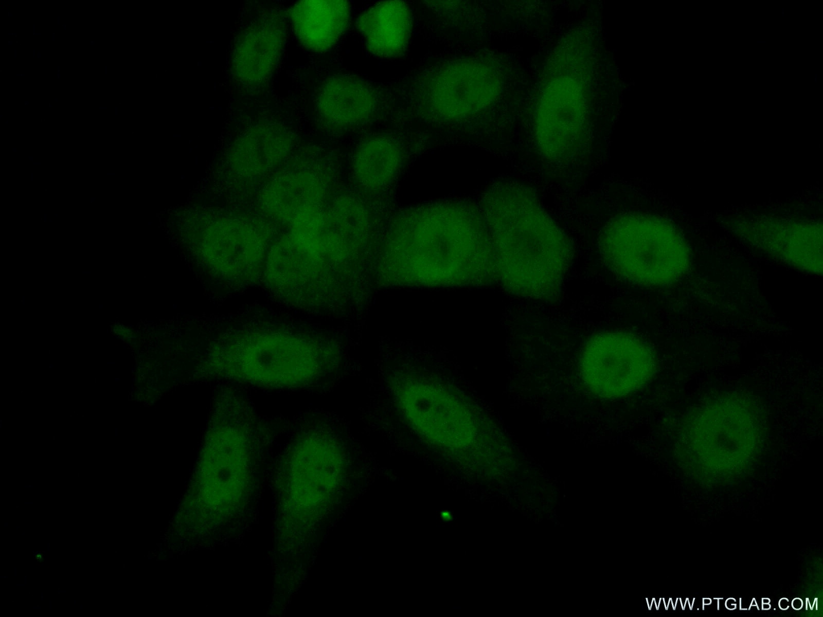 Immunofluorescence (IF) / fluorescent staining of HeLa cells using MORF4L2 Polyclonal antibody (14710-1-AP)