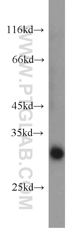 Western Blot (WB) analysis of human liver tissue using MORF4L2 Polyclonal antibody (14710-1-AP)