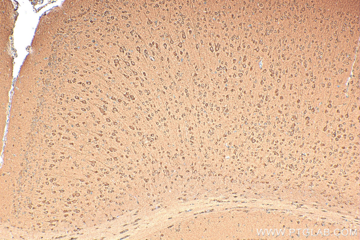 Immunohistochemistry (IHC) staining of mouse brain tissue using MORG1 Polyclonal antibody (27244-1-AP)