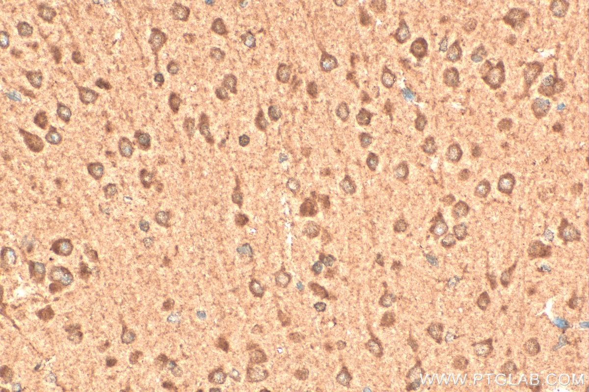 Immunohistochemistry (IHC) staining of mouse brain tissue using MORG1 Polyclonal antibody (27244-1-AP)
