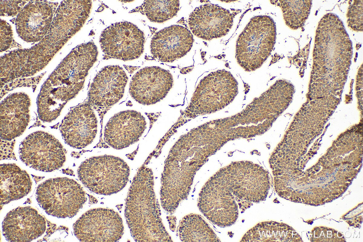Immunohistochemistry (IHC) staining of mouse testis tissue using MORN2 Polyclonal antibody (21224-1-AP)