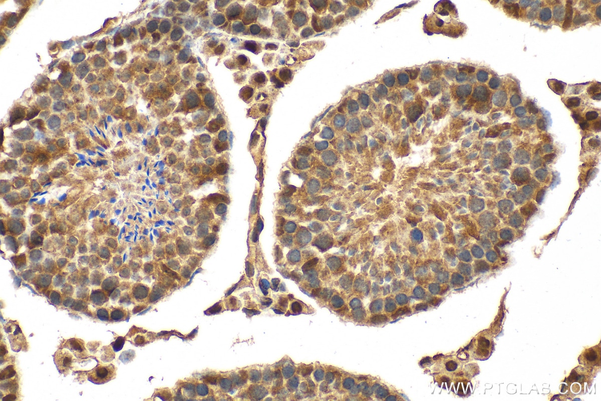 IHC staining of mouse testis using 21224-1-AP