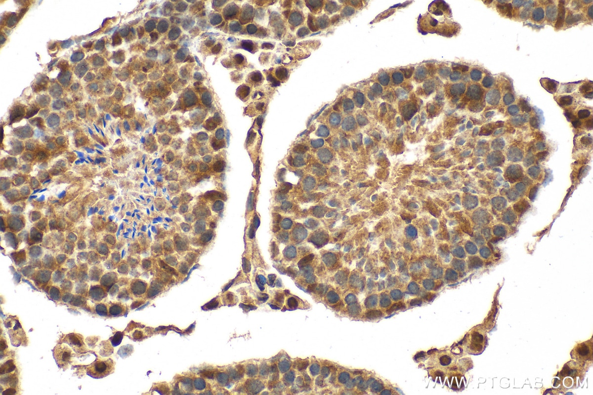 Immunohistochemistry (IHC) staining of mouse testis tissue using MORN2 Polyclonal antibody (21224-1-AP)