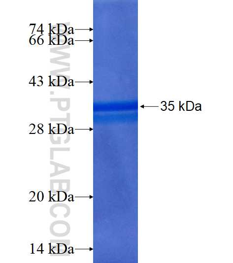 MORN2 fusion protein Ag15665 SDS-PAGE