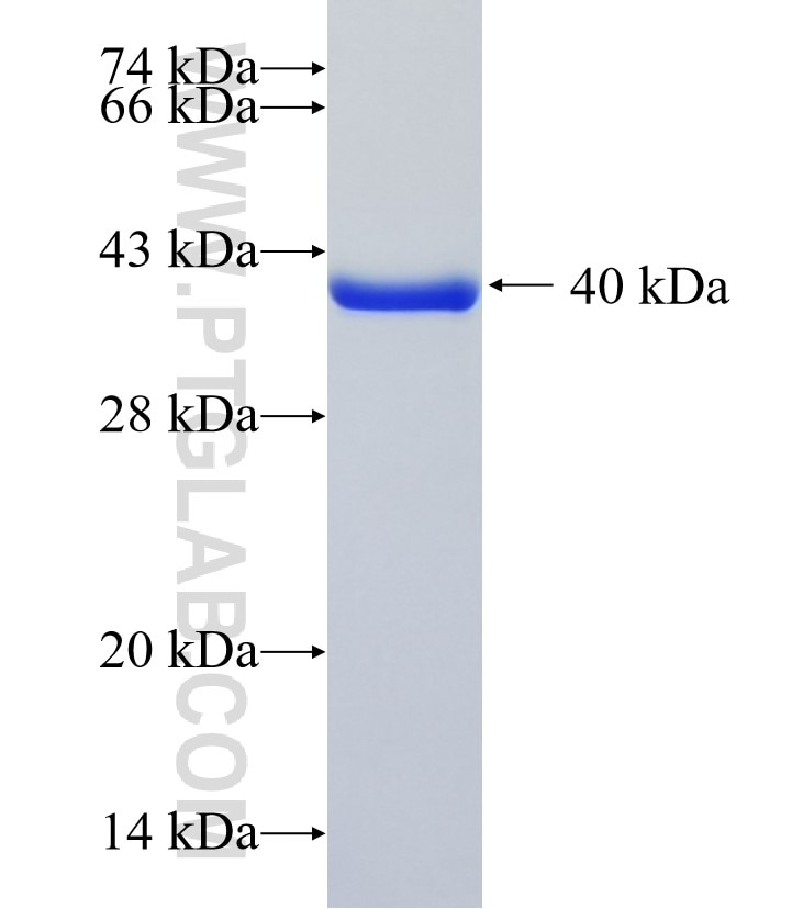 MORN4 fusion protein Ag23769 SDS-PAGE MORN4 fusion protein Ag23769 SDS-PAGE