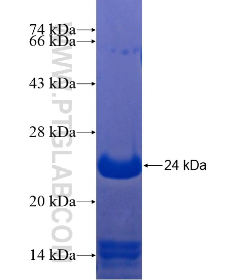 MORN5 fusion protein Ag21691 SDS-PAGE