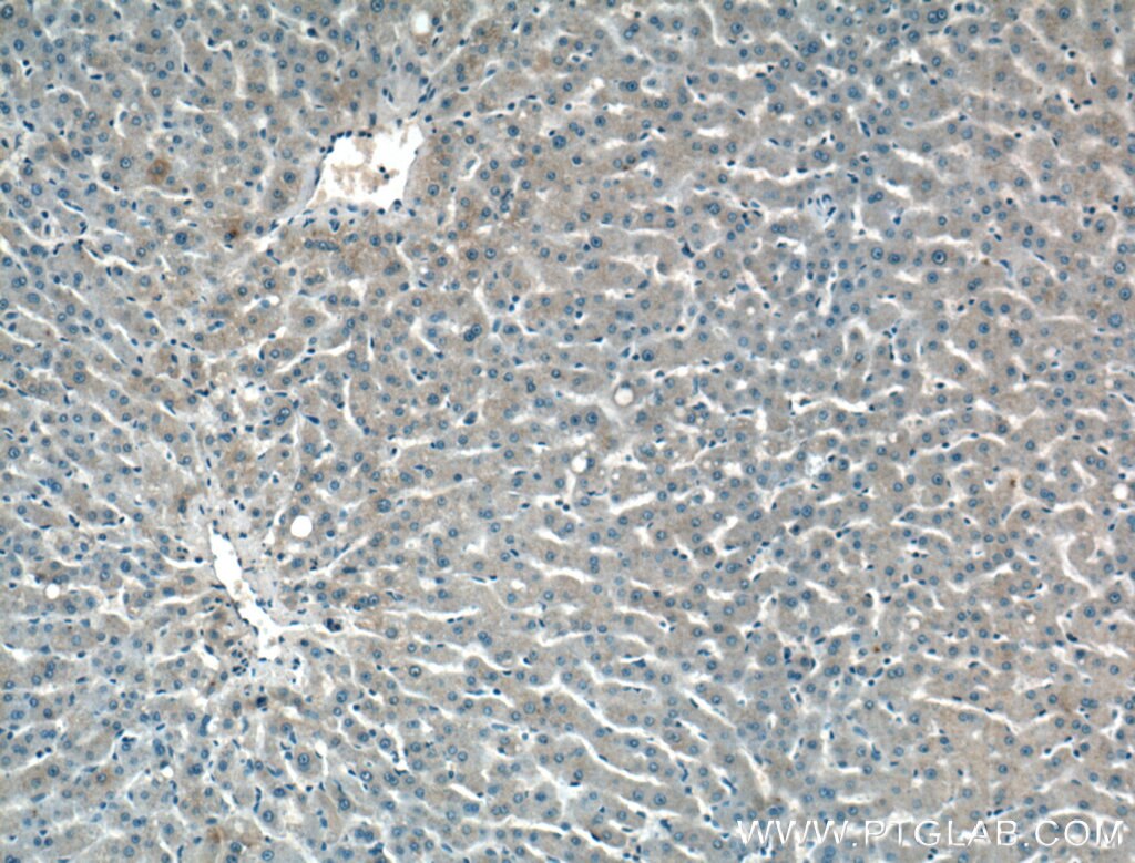 Immunohistochemistry (IHC) staining of human liver tissue using MOS Polyclonal antibody (26454-1-AP)
