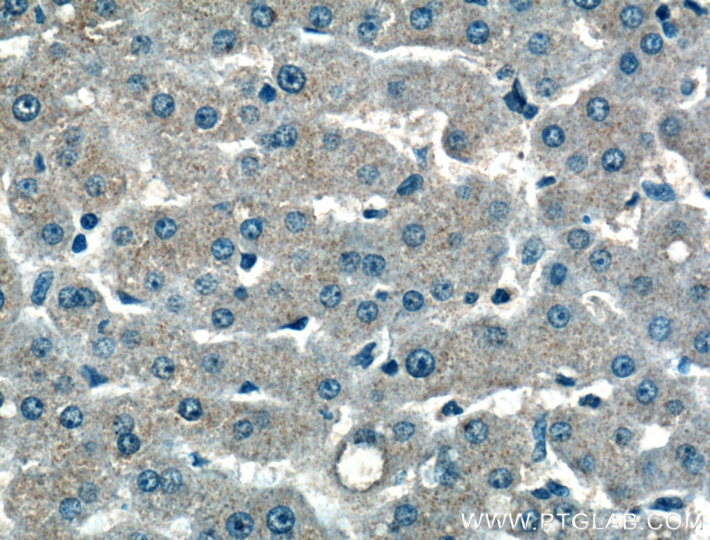 Immunohistochemistry (IHC) staining of human liver tissue using MOS Polyclonal antibody (26454-1-AP)