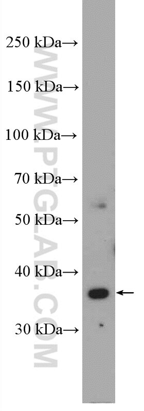 WB analysis of HeLa using 26454-1-AP