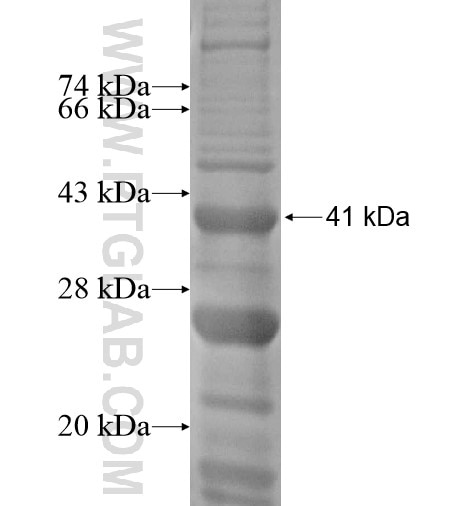 MOS fusion protein Ag15910 SDS-PAGE