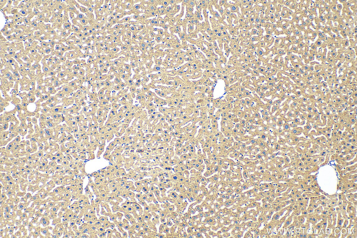 Immunohistochemistry (IHC) staining of mouse liver tissue using MOSC2 Polyclonal antibody (24782-1-AP)
