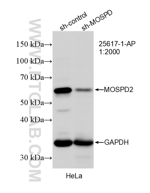 Western Blot (WB) analysis of HeLa cells using MOSPD2 Polyclonal antibody (25617-1-AP)