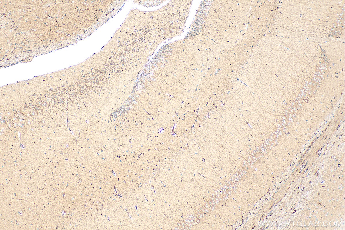 Immunohistochemistry (IHC) staining of mouse brain tissue using MOSPD2 Recombinant antibody (83398-1-RR)