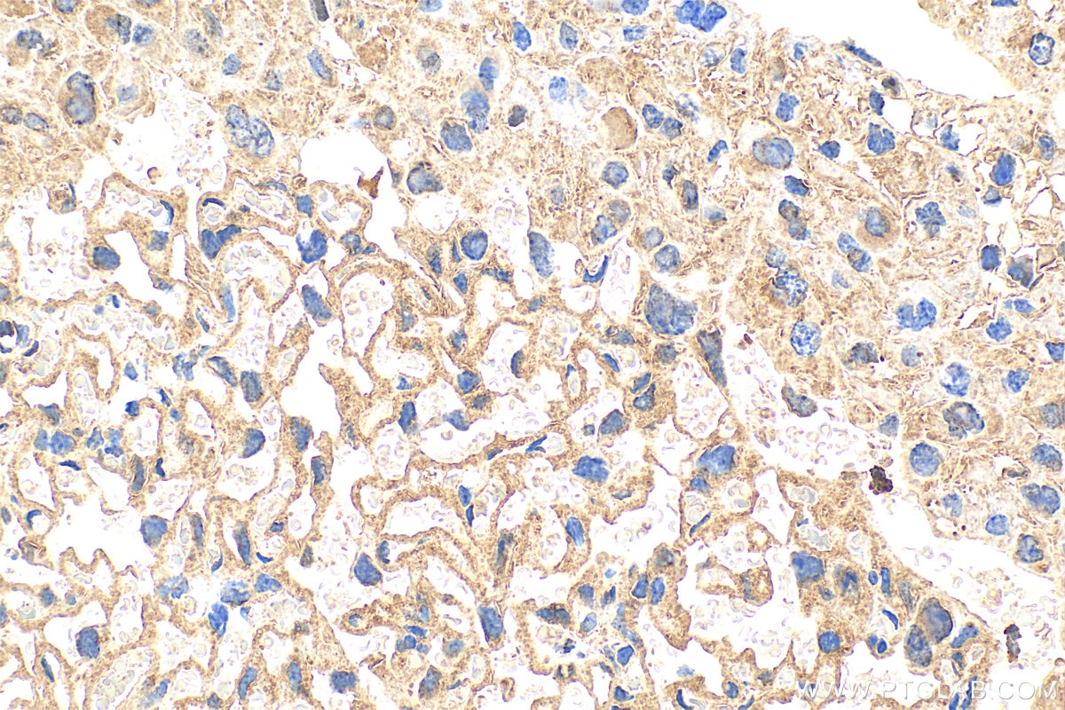 Immunohistochemistry (IHC) staining of mouse placenta tissue using MOSPD2 Recombinant antibody (83398-1-RR)