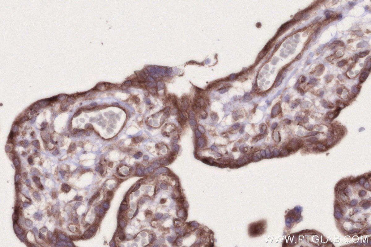 Immunohistochemistry (IHC) staining of human placenta tissue using MOSPD2 Recombinant monoclonal antibody (83398-1-RR)