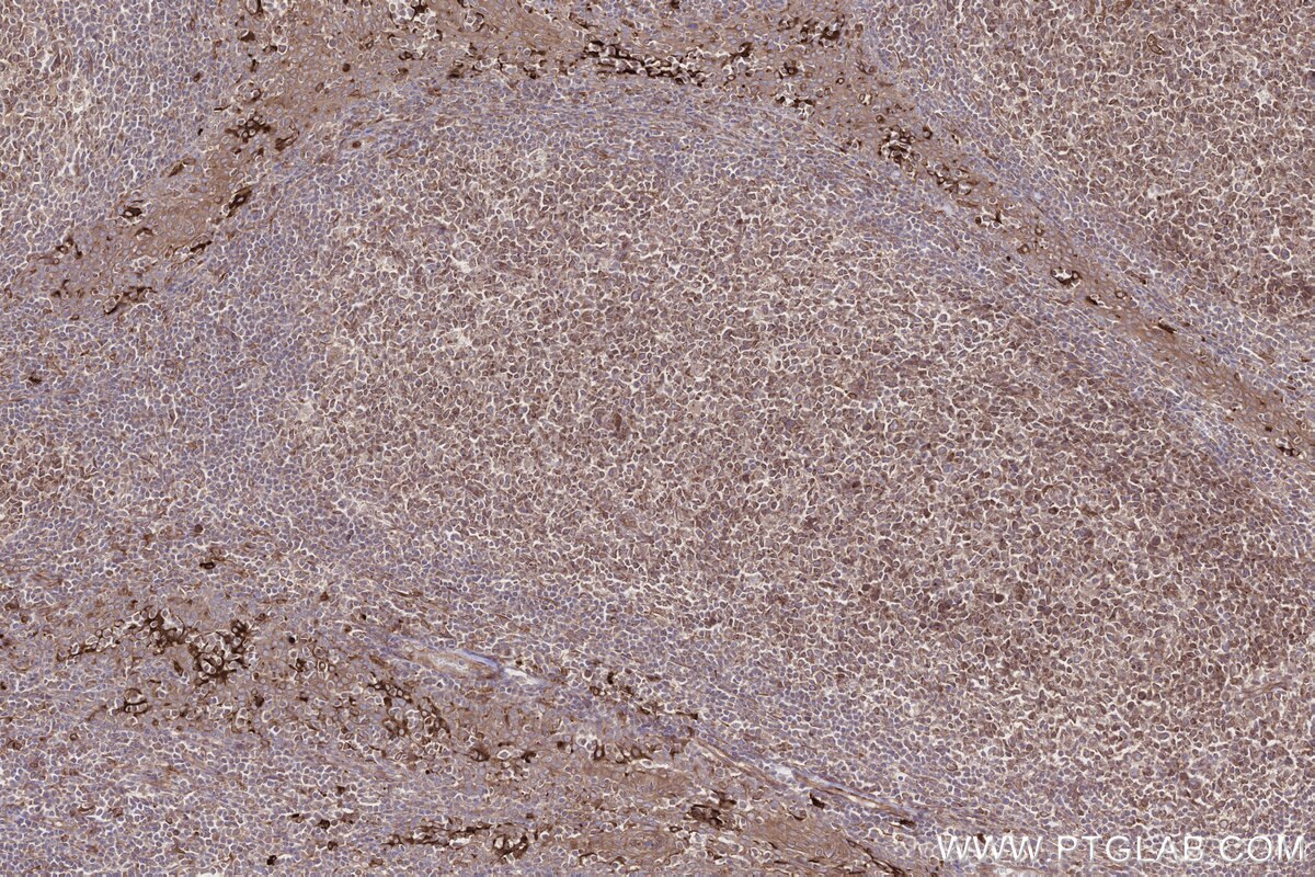 Immunohistochemistry (IHC) staining of human tonsillitis tissue using MOSPD2 Recombinant monoclonal antibody (83398-1-RR)